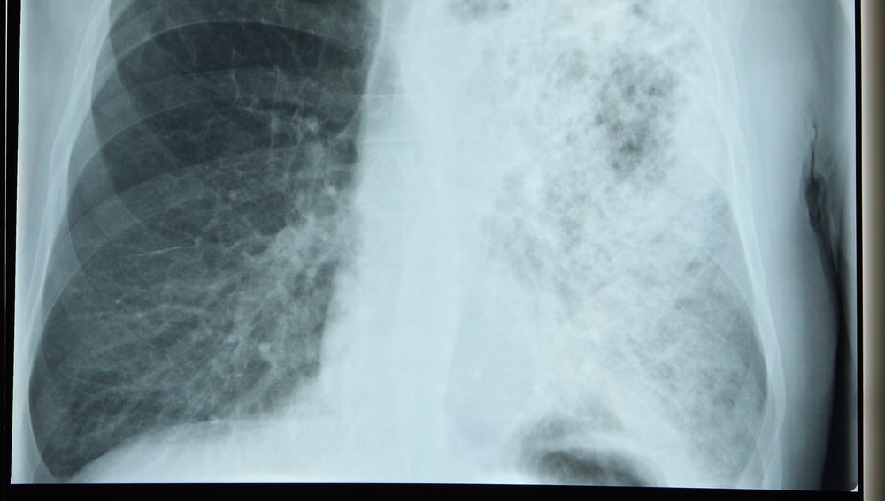 1652285632032 Xraylegionnaire