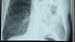 1652285632032 Xraylegionnaire 1652285632032 Xraylegionnaire